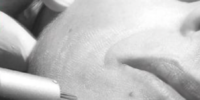 pluser Er:YAG Laser Aesthetics Use_feat